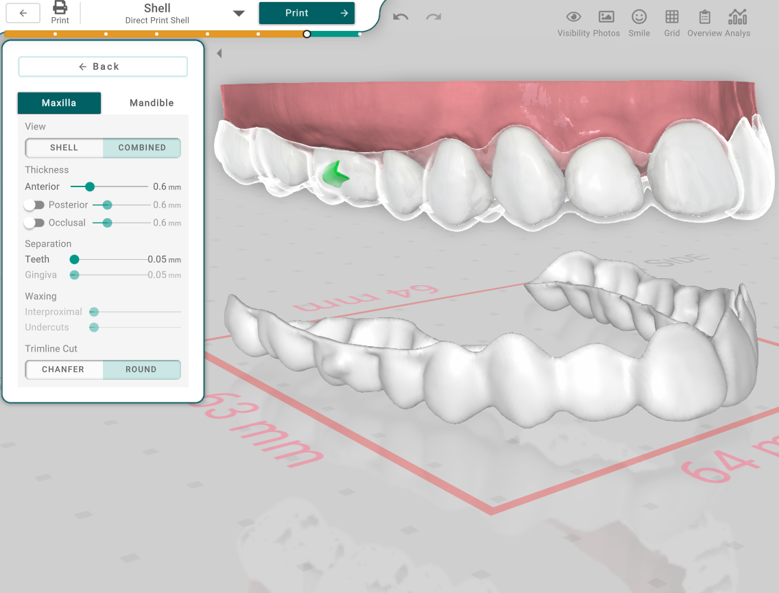 Titan Dental Design v1.2.4 - What's New?