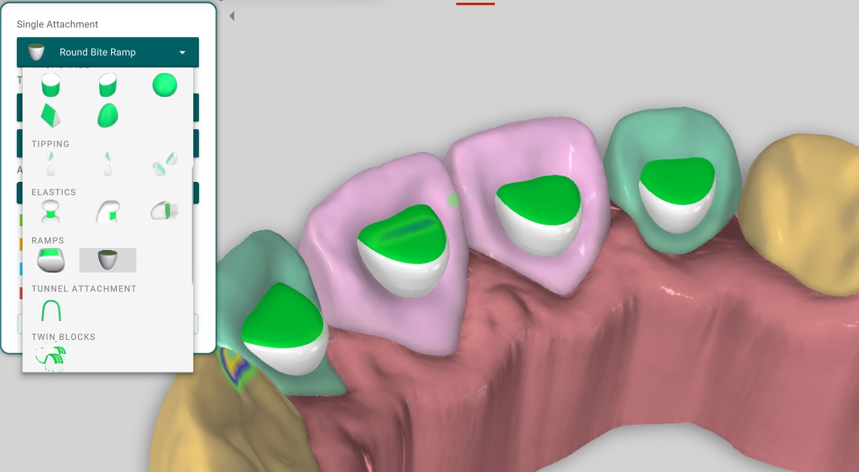 Rounded Bite Ramps