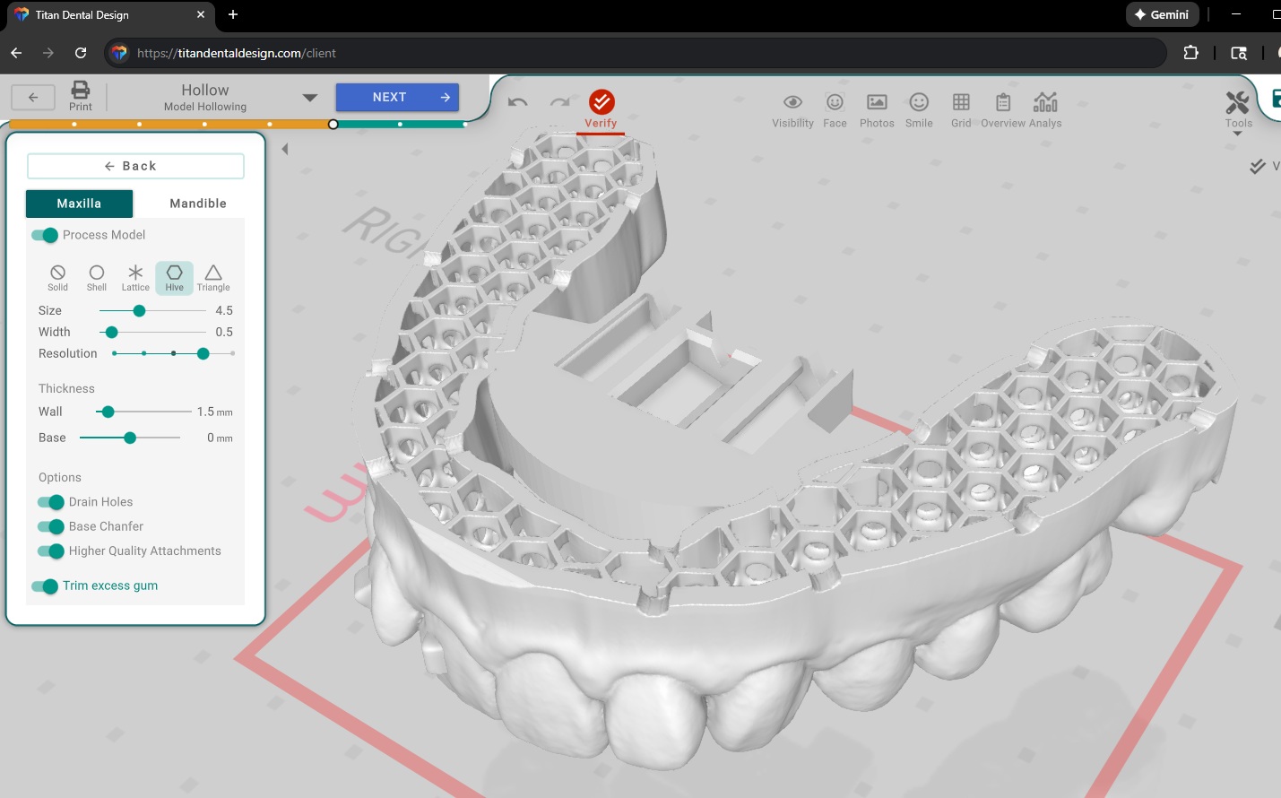 Titan Dental Design v1.2.6 - What's New?