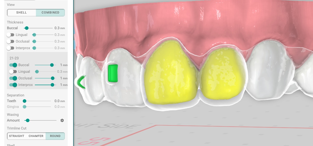 Shell Thickness Per Tooth