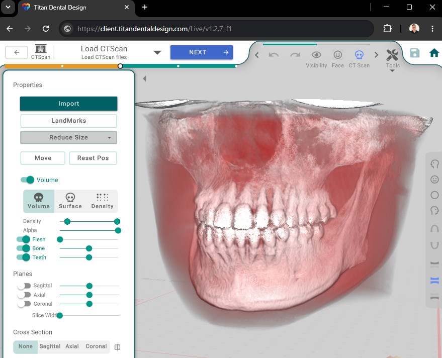 CBCT Import