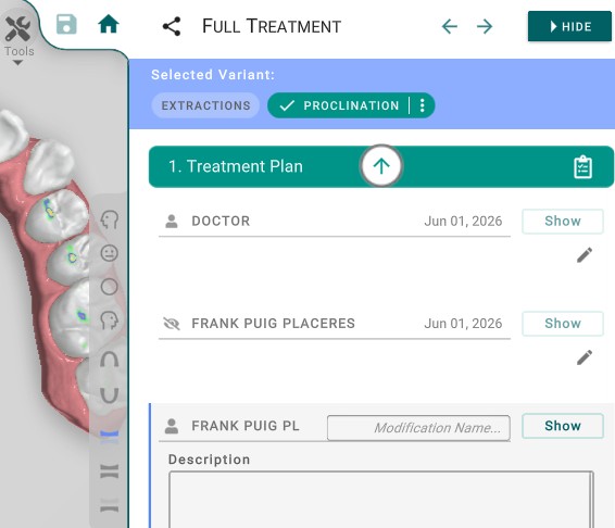 Treatment Plan Variants