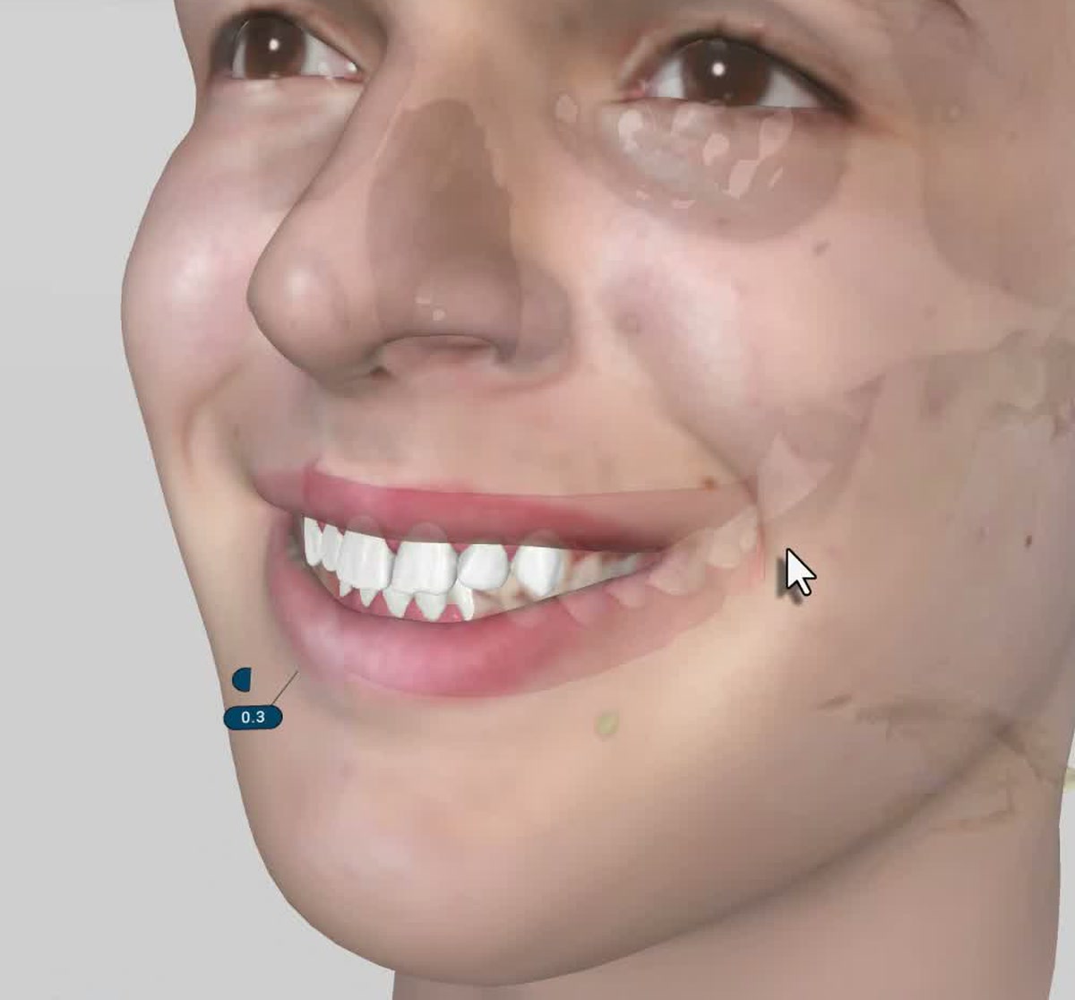 3D Face from Photos