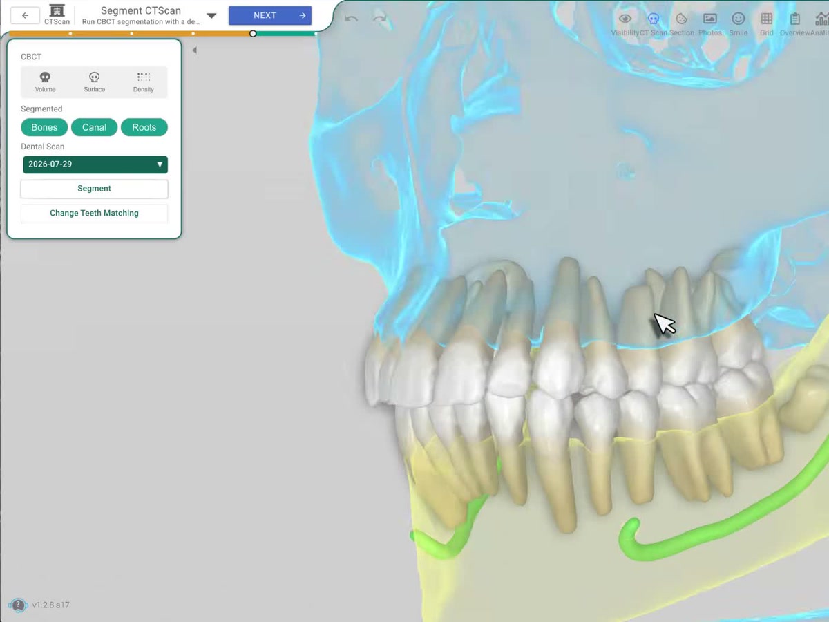 CBCT Segmentation
