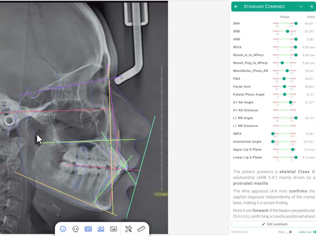 Cephalometrics and Analysis