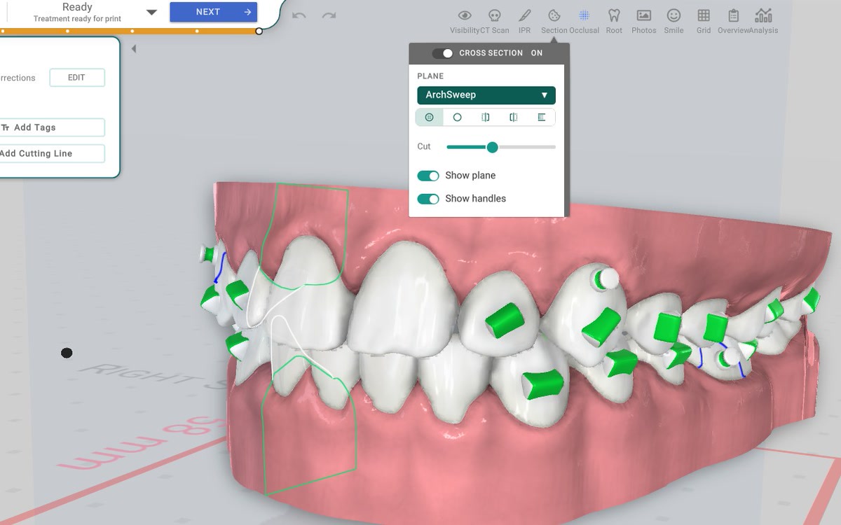 Cross-Section Tool