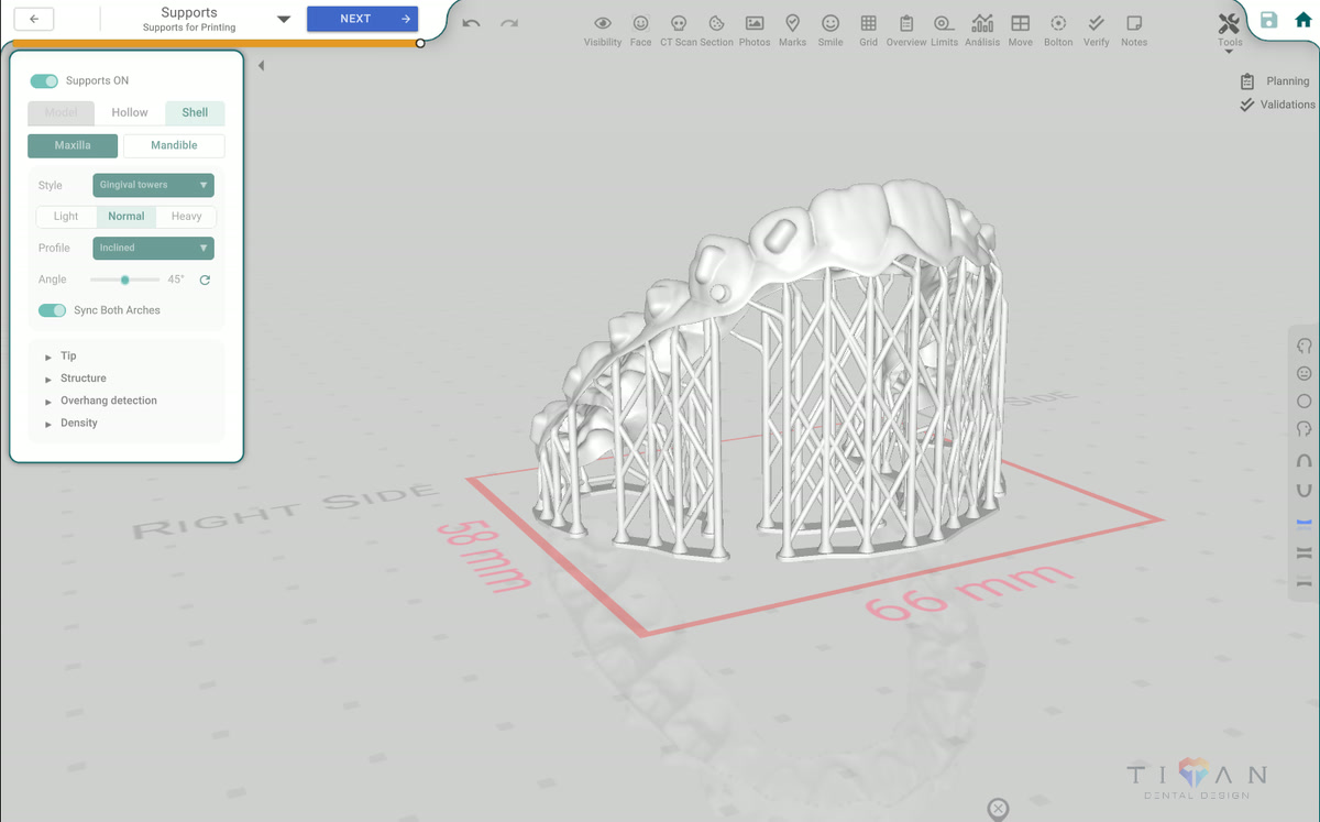 Direct Printing