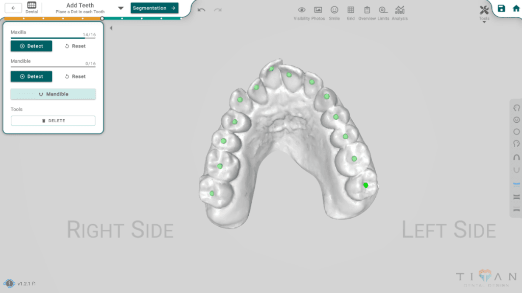 Add Teeth Interface