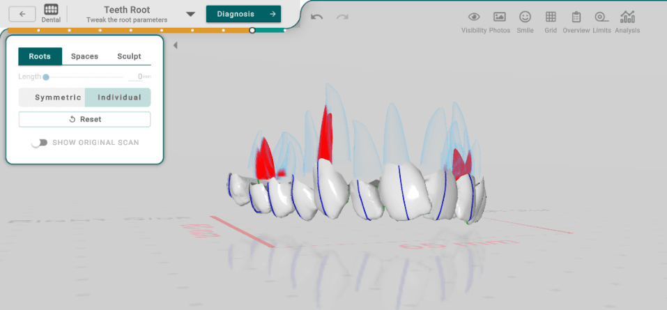 Roots and Spacing Interface