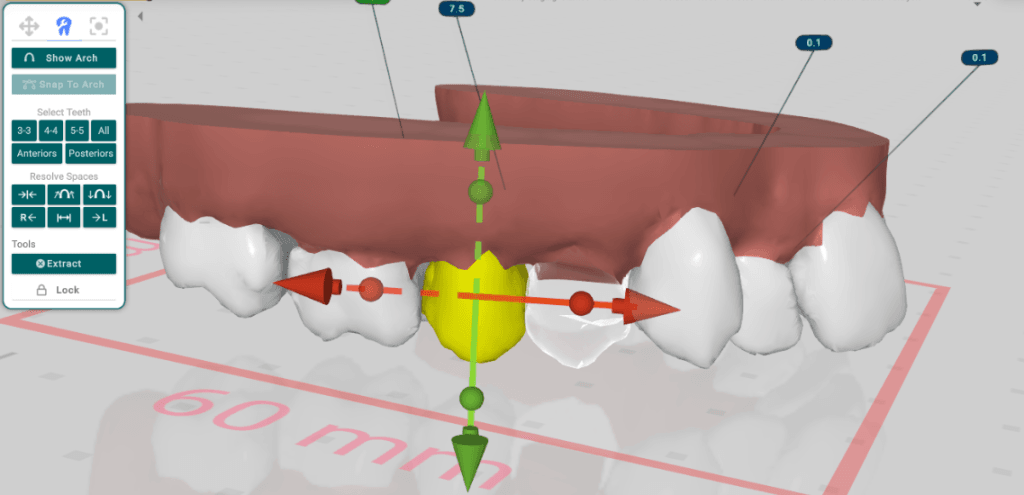 Extractions Interface